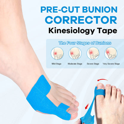 🏆Medical-Grade Bunion Tape – 🦶Hypoallergenic, Breathable, Painless