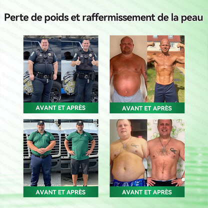 🍇 GLORENDV®𝑴𝒐𝒓𝒊𝐧𝐠𝙖 · 𝘽𝙚𝙧𝙗é𝙧𝒊𝒏𝒆 ×𝐍𝘼𝗗+ 𝟭0-𝒆𝒏-𝟏 𝐏𝐚𝙩𝙘𝙝 𝙈𝙞𝙘𝙧𝙤𝙣é𝙚𝒅𝒍𝒆 𝑨𝒗𝒂𝐧𝐜é 𝙉𝙖𝒏𝒐🇫🇷(𝐔𝐧𝐞 𝐬𝐞𝐮𝐥𝐞 𝐟𝐨𝐢𝐬 𝐩𝐚𝐫 𝐣𝐨𝐮𝐫, 𝐜𝐡𝐚𝐧𝐠𝐞𝐦𝐞𝐧𝐭𝐬 𝐯𝐢𝐬𝐢𝐛𝐥𝐞𝐬 𝐞𝐧 𝟕 𝐣𝐨𝐮𝐫𝐬） ✅ 𝐏𝐨𝐮𝐫 𝐥’𝐨𝐛é𝐬𝐢𝐭é, 🅟🅔🅐🅤 🅡🅔🅛â🅒🅗é🅔,𝐝𝐢𝐚𝐛è𝐭𝐞, 𝐚𝐩𝐧é𝐞 𝐝𝐮 𝐬𝐨𝐦𝐦𝐞𝐢𝐥, 𝐩𝐫𝐨𝐛𝐥è𝐦𝐞𝐬 𝐚𝐫𝐭𝐢𝐜𝐮𝐥𝐚𝐢𝐫𝐞𝐬, 𝐞𝐭 𝐛𝐢𝐞𝐧 𝐩𝐥𝐮𝐬