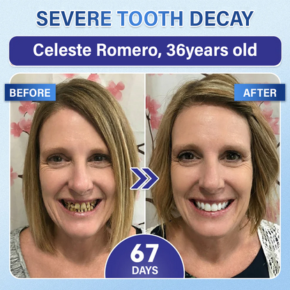 ZOVRL™ Tooth & Gum Repair Fast-Dissolving Microneedle Patch✨ (𝟓-𝐢𝐧-𝟏 💎 𝐑𝐞𝐛𝐮𝐢𝐥𝐝 𝐄𝐧𝐚𝐦𝐞𝐥 & 𝐃𝐞𝐧𝐭𝐢𝐧 • 𝐒𝐭𝐫𝐞𝐧𝐠𝐭𝐡𝐞𝐧 𝐆𝐮𝐦𝐬 • 𝐄𝐫𝐚𝐝𝐢𝐜𝐚𝐭𝐞 𝐓𝐚𝐫𝐭𝐚𝐫 & 𝐎𝐝𝐨𝐫 • 𝐖𝐡𝐢𝐭𝐞𝐧𝐢𝐧𝐠 • 𝐒𝐭𝐨𝐩 𝐓𝐨𝐨𝐭𝐡 𝐒𝐞𝐧𝐬𝐢𝐭𝐢𝐯𝐢𝐭𝐲)