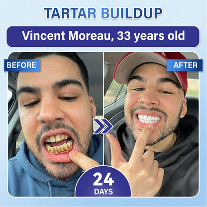 ZOVRL™ Tooth & Gum Repair Fast-Dissolving Microneedle Patch✨ (𝟓-𝐢𝐧-𝟏 💎 𝐑𝐞𝐛𝐮𝐢𝐥𝐝 𝐄𝐧𝐚𝐦𝐞𝐥 & 𝐃𝐞𝐧𝐭𝐢𝐧 • 𝐒𝐭𝐫𝐞𝐧𝐠𝐭𝐡𝐞𝐧 𝐆𝐮𝐦𝐬 • 𝐄𝐫𝐚𝐝𝐢𝐜𝐚𝐭𝐞 𝐓𝐚𝐫𝐭𝐚𝐫 & 𝐎𝐝𝐨𝐫 • 𝐖𝐡𝐢𝐭𝐞𝐧𝐢𝐧𝐠 • 𝐒𝐭𝐨𝐩 𝐓𝐨𝐨𝐭𝐡 𝐒𝐞𝐧𝐬𝐢𝐭𝐢𝐯𝐢𝐭𝐲)