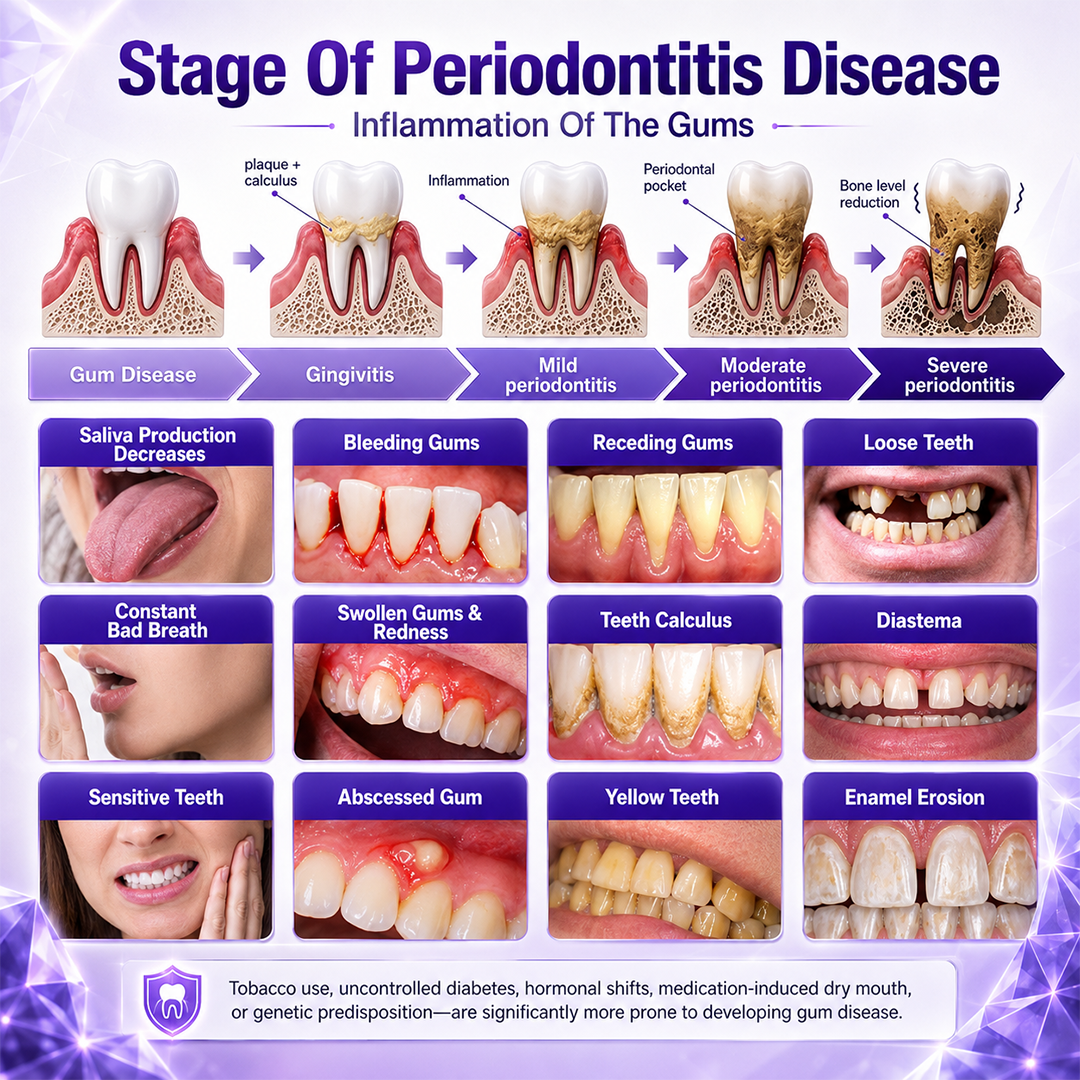 🏆ZORVL™ Gingivitis Periodontal Treatment Toothpaste