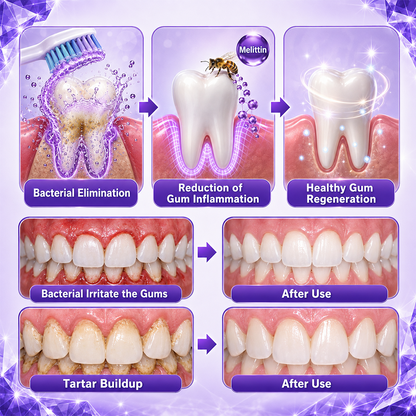 🏆ZORVL™ Gingivitis Periodontal Treatment Toothpaste