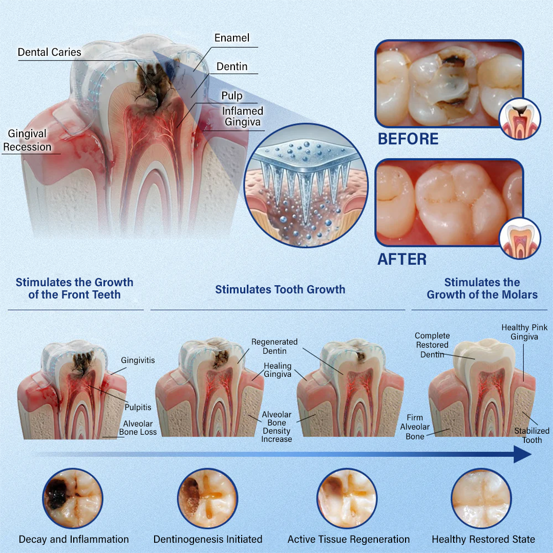 ZOVRL™ Tooth & Gum Repair Fast-Dissolving Microneedle Patch✨ (𝟓-𝐢𝐧-𝟏 💎 𝐑𝐞𝐛𝐮𝐢𝐥𝐝 𝐄𝐧𝐚𝐦𝐞𝐥 & 𝐃𝐞𝐧𝐭𝐢𝐧 • 𝐒𝐭𝐫𝐞𝐧𝐠𝐭𝐡𝐞𝐧 𝐆𝐮𝐦𝐬 • 𝐄𝐫𝐚𝐝𝐢𝐜𝐚𝐭𝐞 𝐓𝐚𝐫𝐭𝐚𝐫 & 𝐎𝐝𝐨𝐫 • 𝐖𝐡𝐢𝐭𝐞𝐧𝐢𝐧𝐠 • 𝐒𝐭𝐨𝐩 𝐓𝐨𝐨𝐭𝐡 𝐒𝐞𝐧𝐬𝐢𝐭𝐢𝐯𝐢𝐭𝐲)