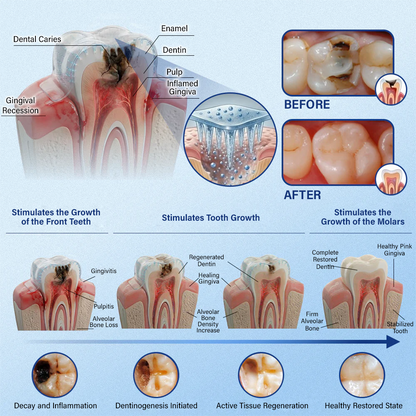ZOVRL™ Tooth & Gum Repair Fast-Dissolving Microneedle Patch✨ (𝟓-𝐢𝐧-𝟏 💎 𝐑𝐞𝐛𝐮𝐢𝐥𝐝 𝐄𝐧𝐚𝐦𝐞𝐥 & 𝐃𝐞𝐧𝐭𝐢𝐧 • 𝐒𝐭𝐫𝐞𝐧𝐠𝐭𝐡𝐞𝐧 𝐆𝐮𝐦𝐬 • 𝐄𝐫𝐚𝐝𝐢𝐜𝐚𝐭𝐞 𝐓𝐚𝐫𝐭𝐚𝐫 & 𝐎𝐝𝐨𝐫 • 𝐖𝐡𝐢𝐭𝐞𝐧𝐢𝐧𝐠 • 𝐒𝐭𝐨𝐩 𝐓𝐨𝐨𝐭𝐡 𝐒𝐞𝐧𝐬𝐢𝐭𝐢𝐯𝐢𝐭𝐲)