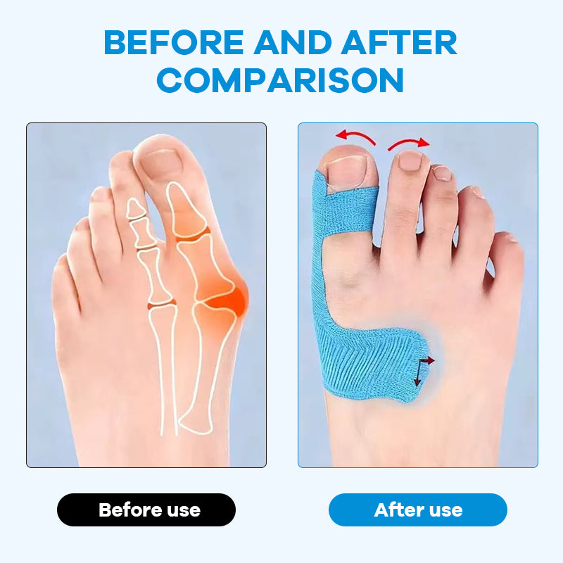 🏆Medical-Grade Bunion Tape – 🦶Hypoallergenic, Breathable, Painless