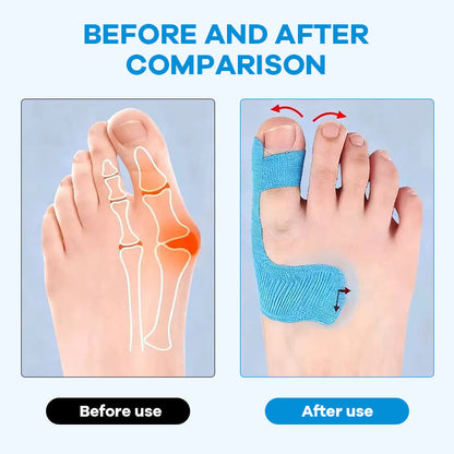 🏆Medical-Grade Bunion Tape – 🦶Hypoallergenic, Breathable, Painless