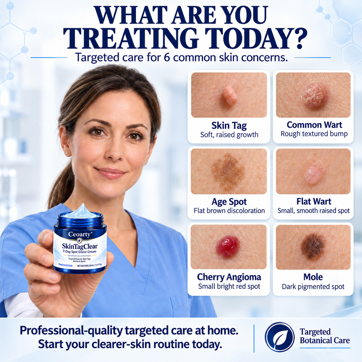 Ceoarty® SkinTagClear 7-Day Spot Eraser Cream